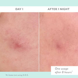 S.O.S. Totally Invisible Clarifying Liquid Patch