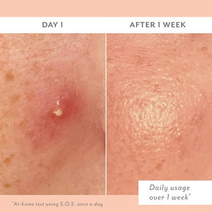 S.O.S. Totally Invisible Clarifying Liquid Patch