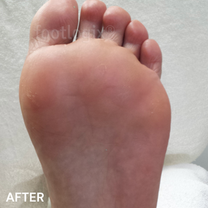 #7 Peeling Skin Formula