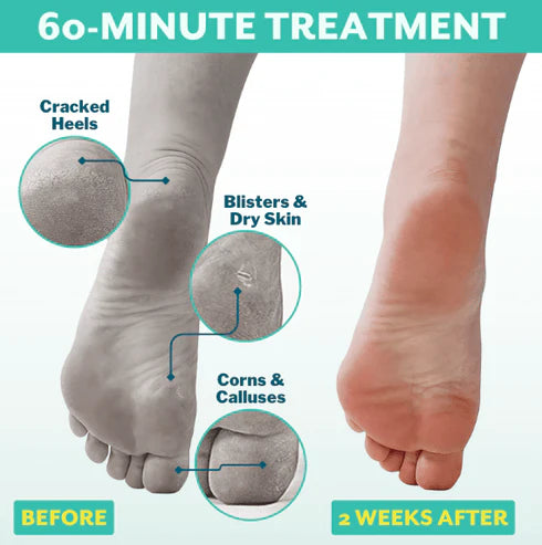 POSHPEEL™ Pedi Cure - Single