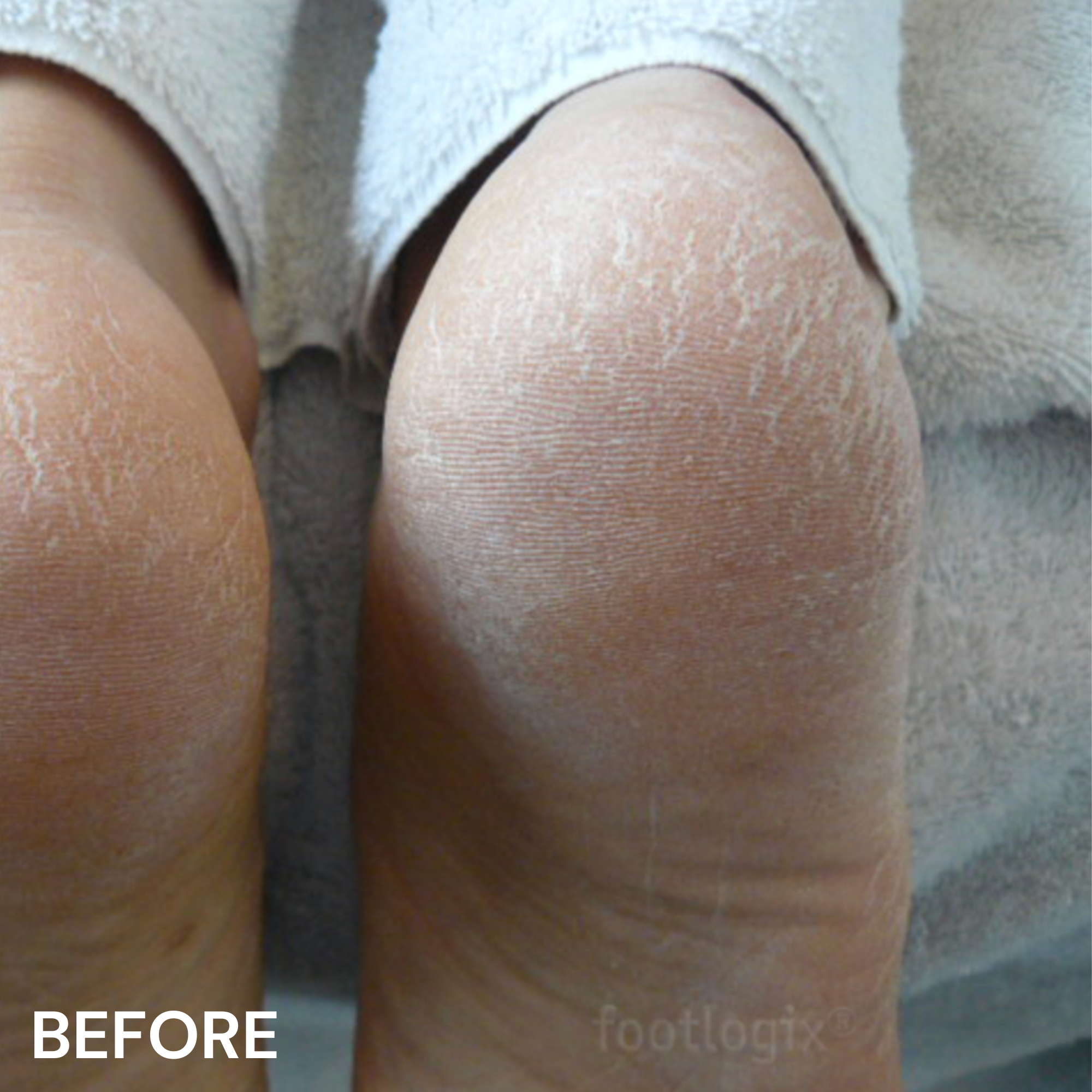 #3 Very Dry Skin Formula