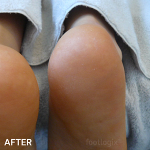 #3 Very Dry Skin Formula