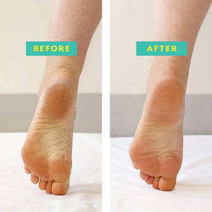 POSHPEEL™ Pedi Cure - Single